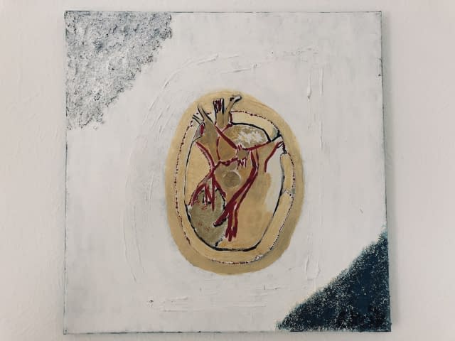 Image 1 of the artwork "golden heart" by Eda Incik on art24